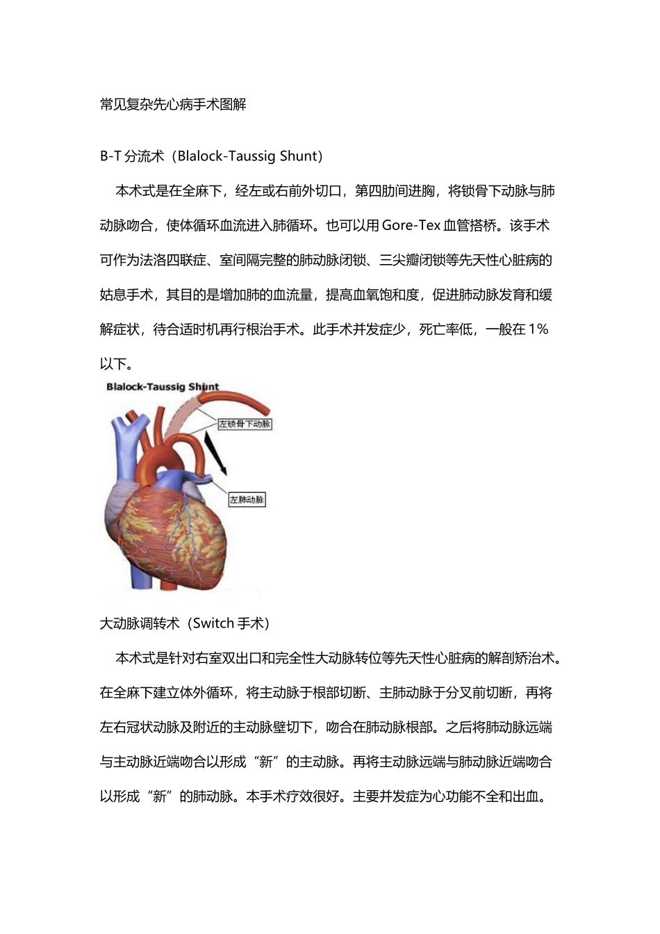 常见复杂先心病手术图解_第2页