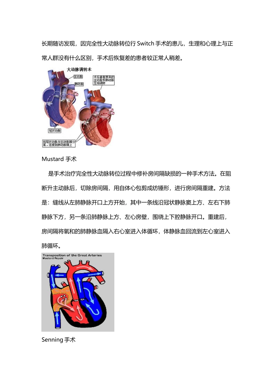 常见复杂先心病手术图解_第3页