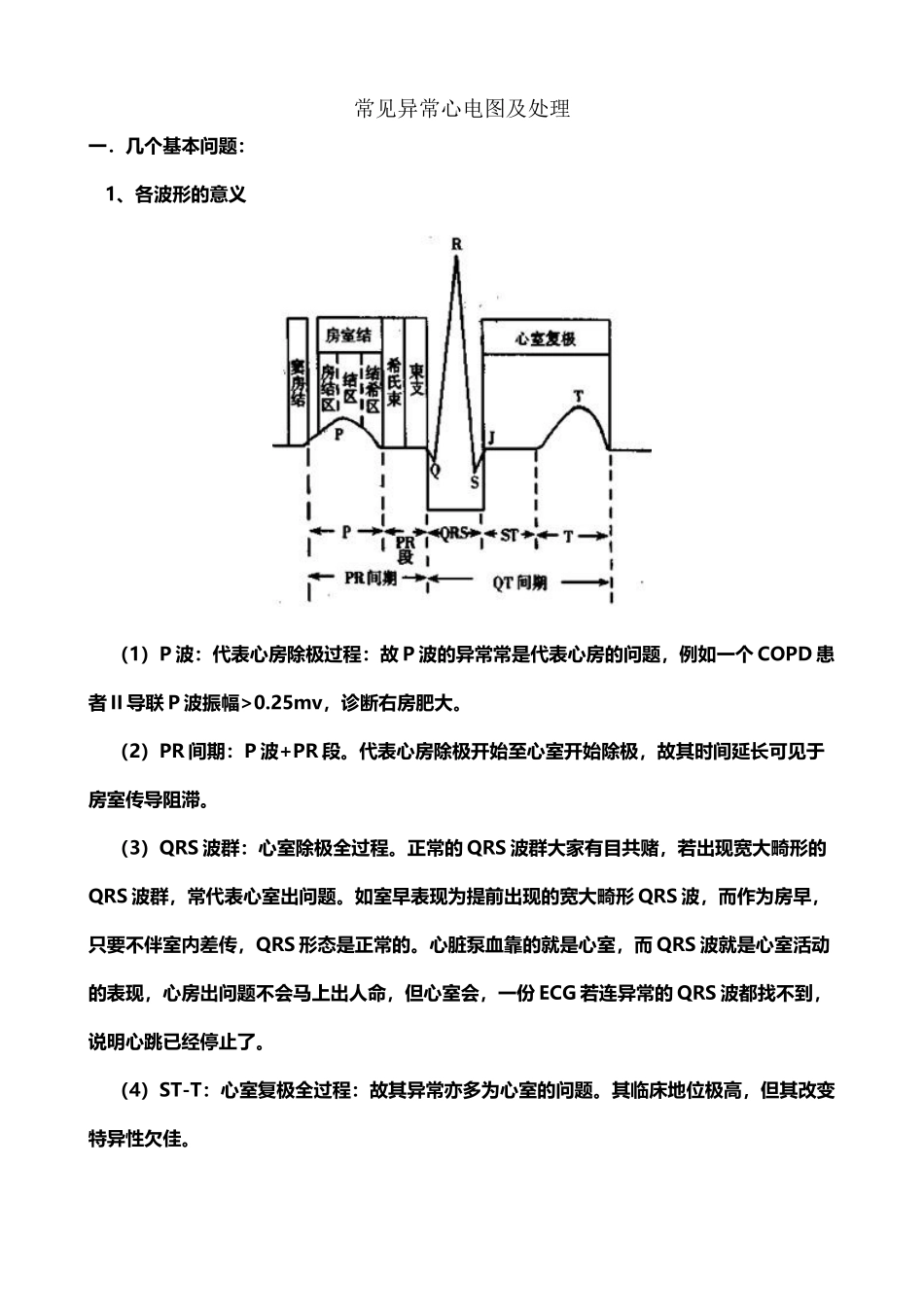 常见异常心电图及处理_第2页