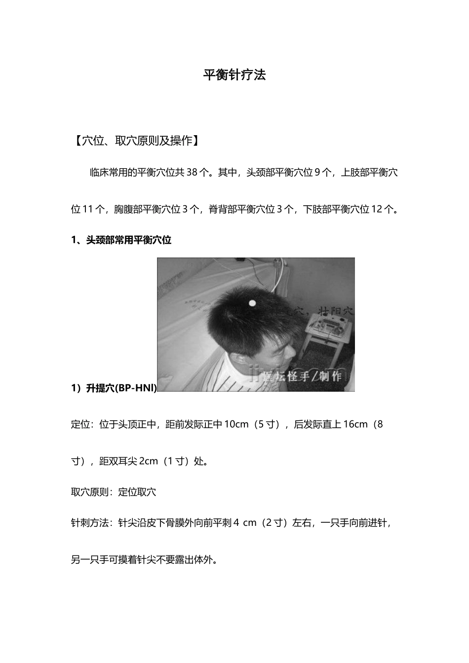 平衡针疗法附穴位图-_第2页
