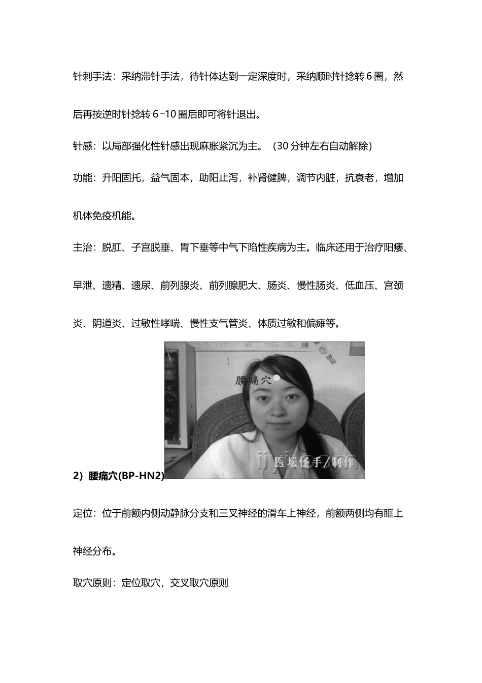 平衡针疗法附穴位图-_第3页