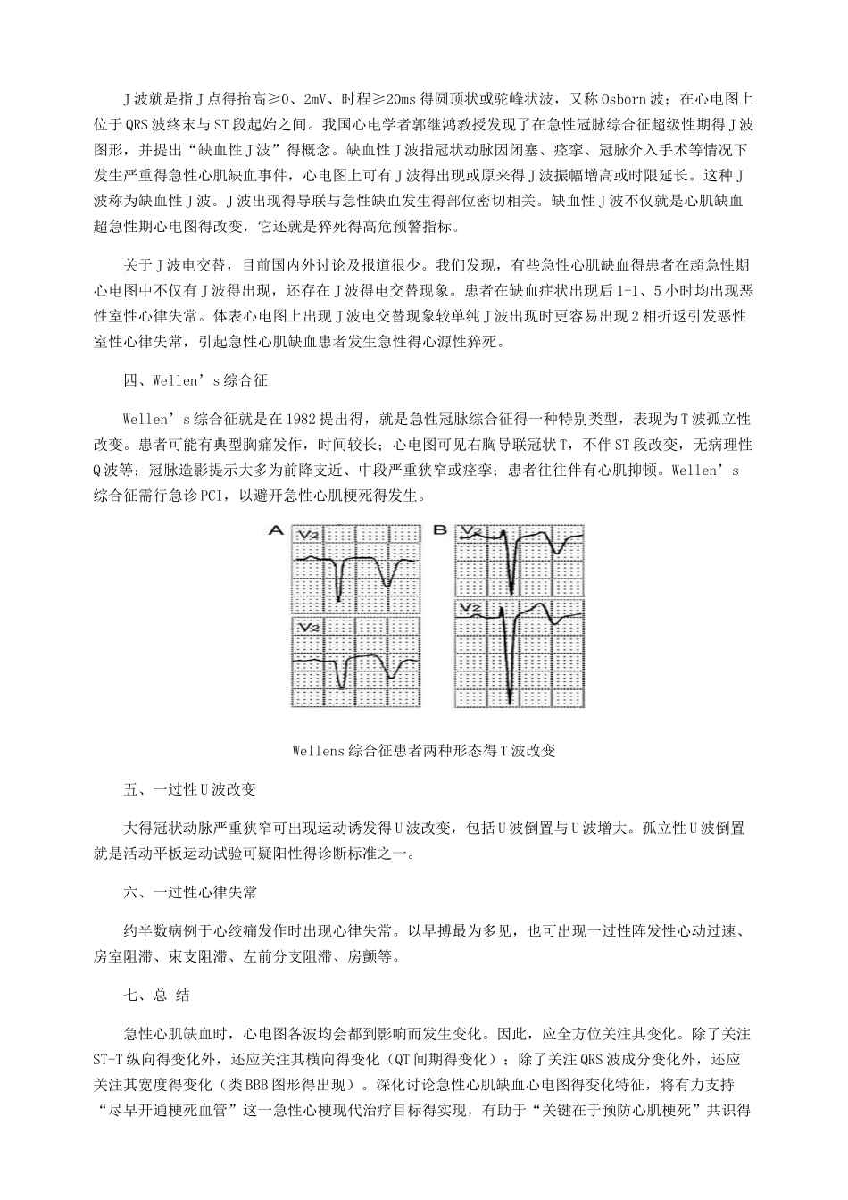 心肌缺血心电图分析_第3页