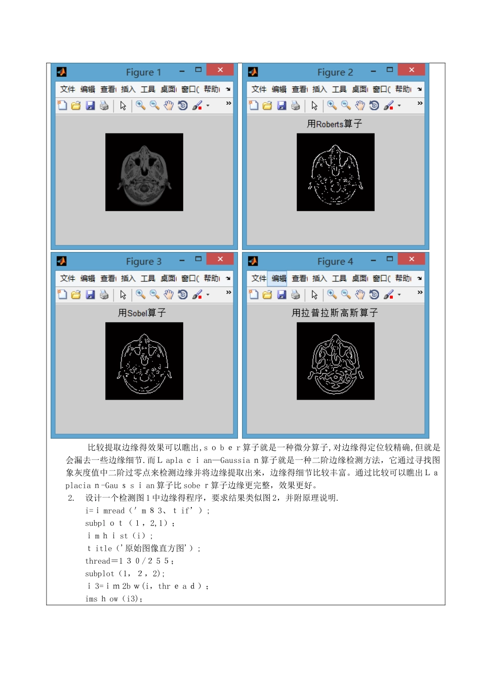 数字图像处理实验报告——图像分割实验_第3页