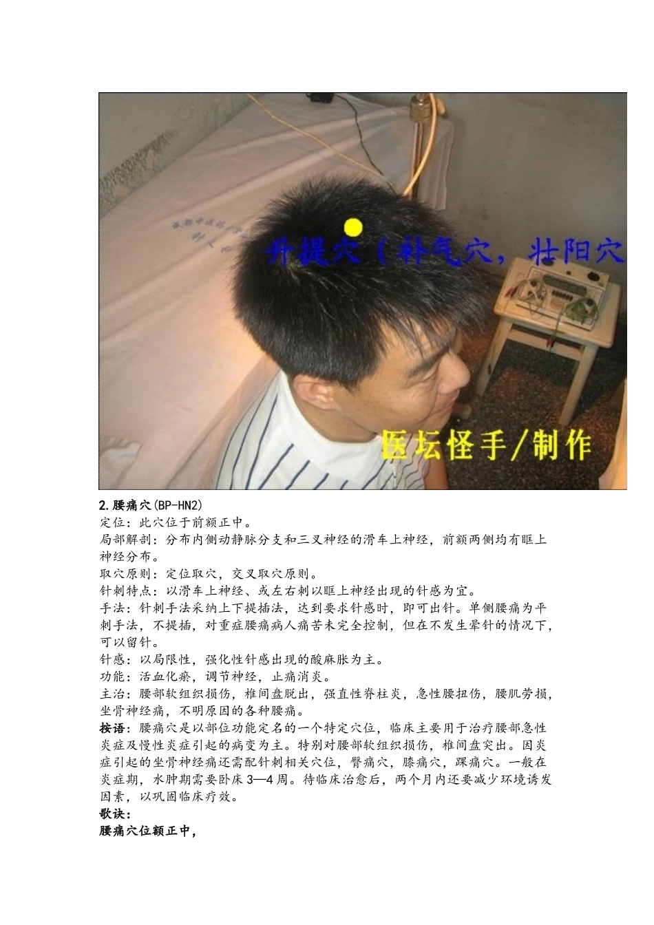 王文远平衡针灸穴位图带图_第2页