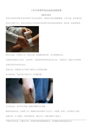 班组安全培训-各种外伤出血的急救处理