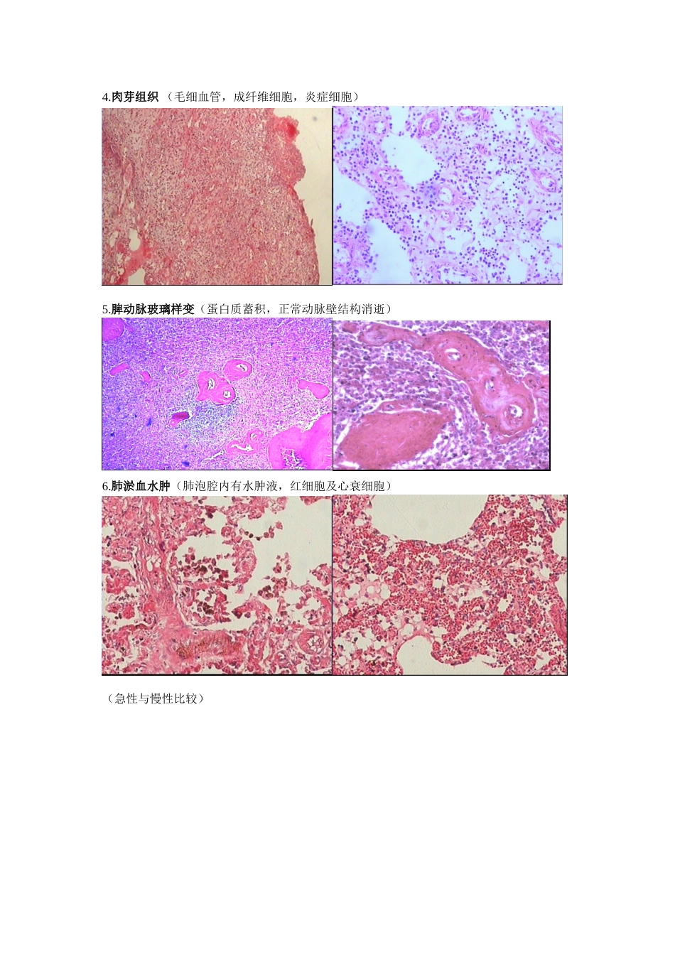 病理实验切片图片整理_第2页