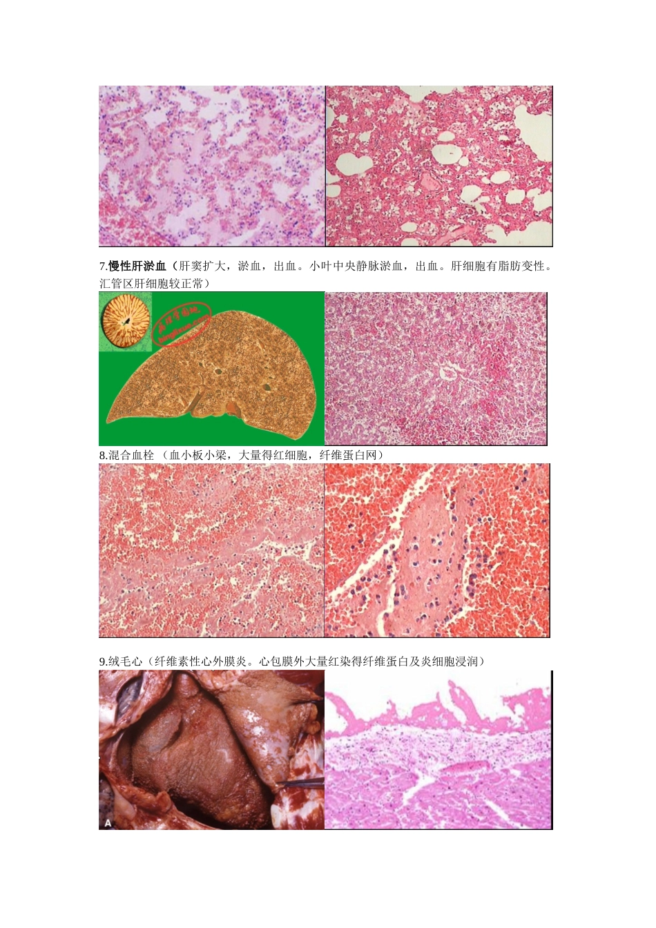 病理实验切片图片整理_第3页