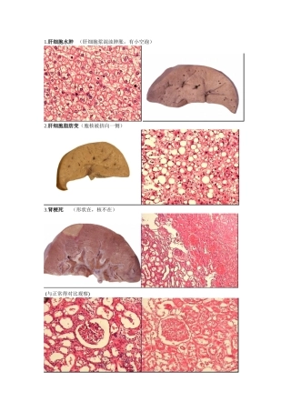 病理实验切片图片整理
