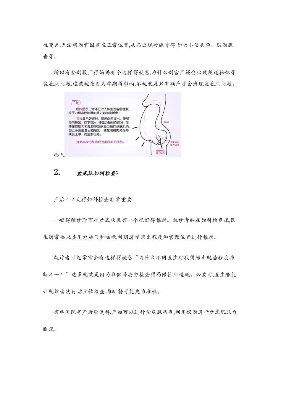 盆底肌康复知识讲座_第2页