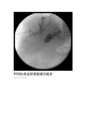 经皮穿刺肝胆管引流术