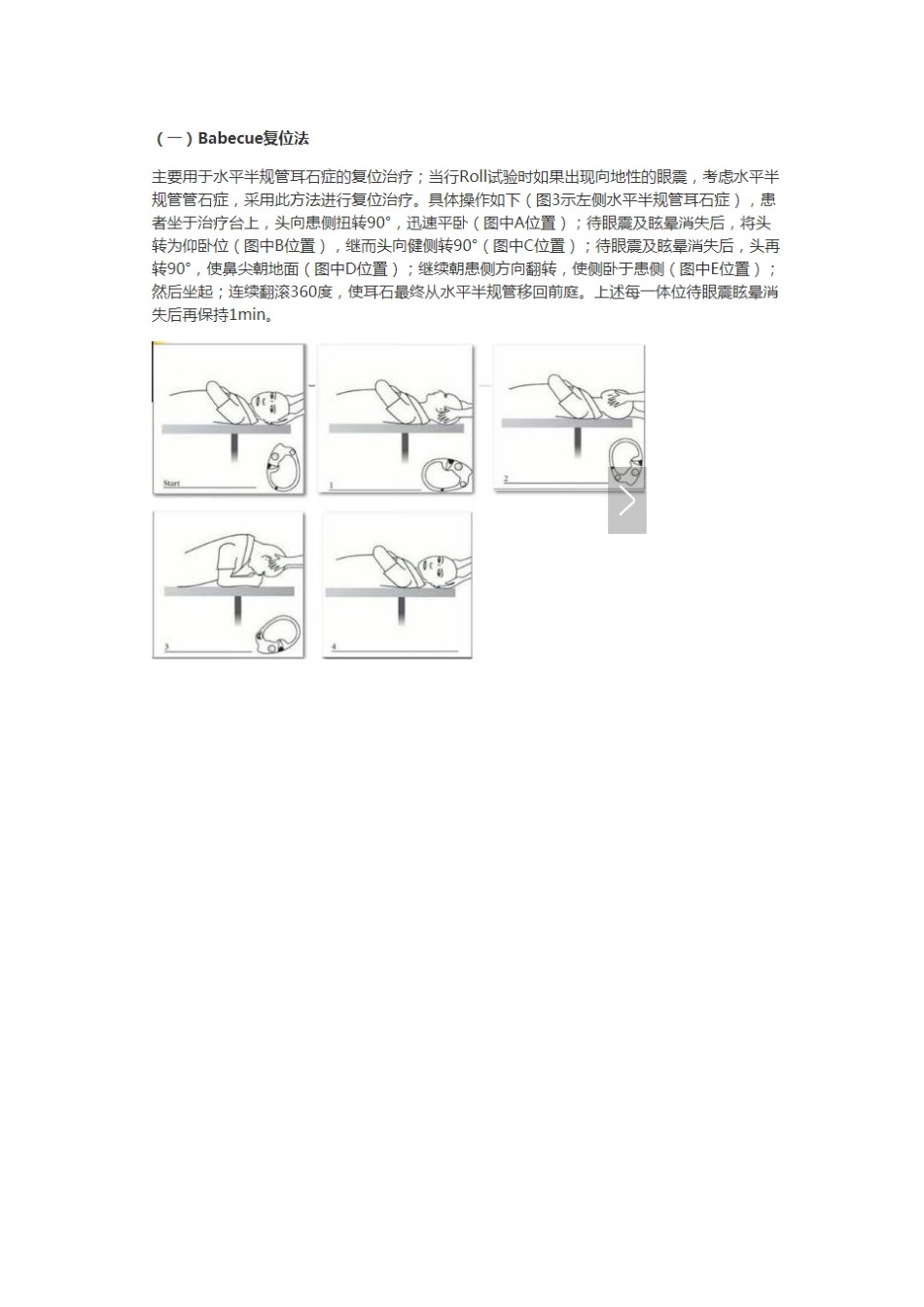 耳石症检测实验及复位手法大全_第3页