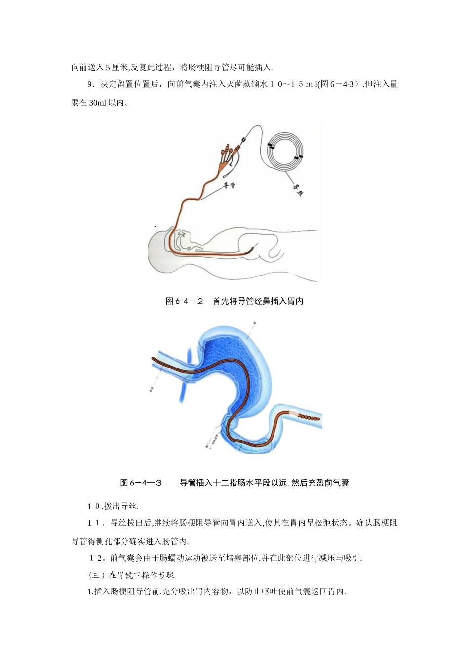 肠梗阻导管套件使用_第3页