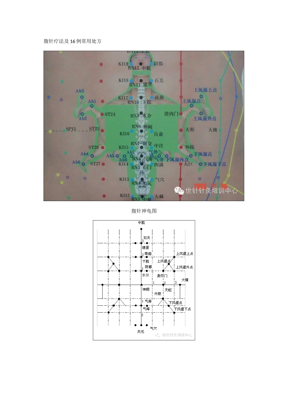 腹针疗法及16例常用处方_第1页
