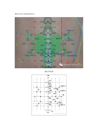腹针疗法及16例常用处方