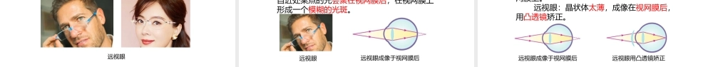 （2024人教版）八年级物理上册5.4   眼睛与眼镜  核心素养课件 