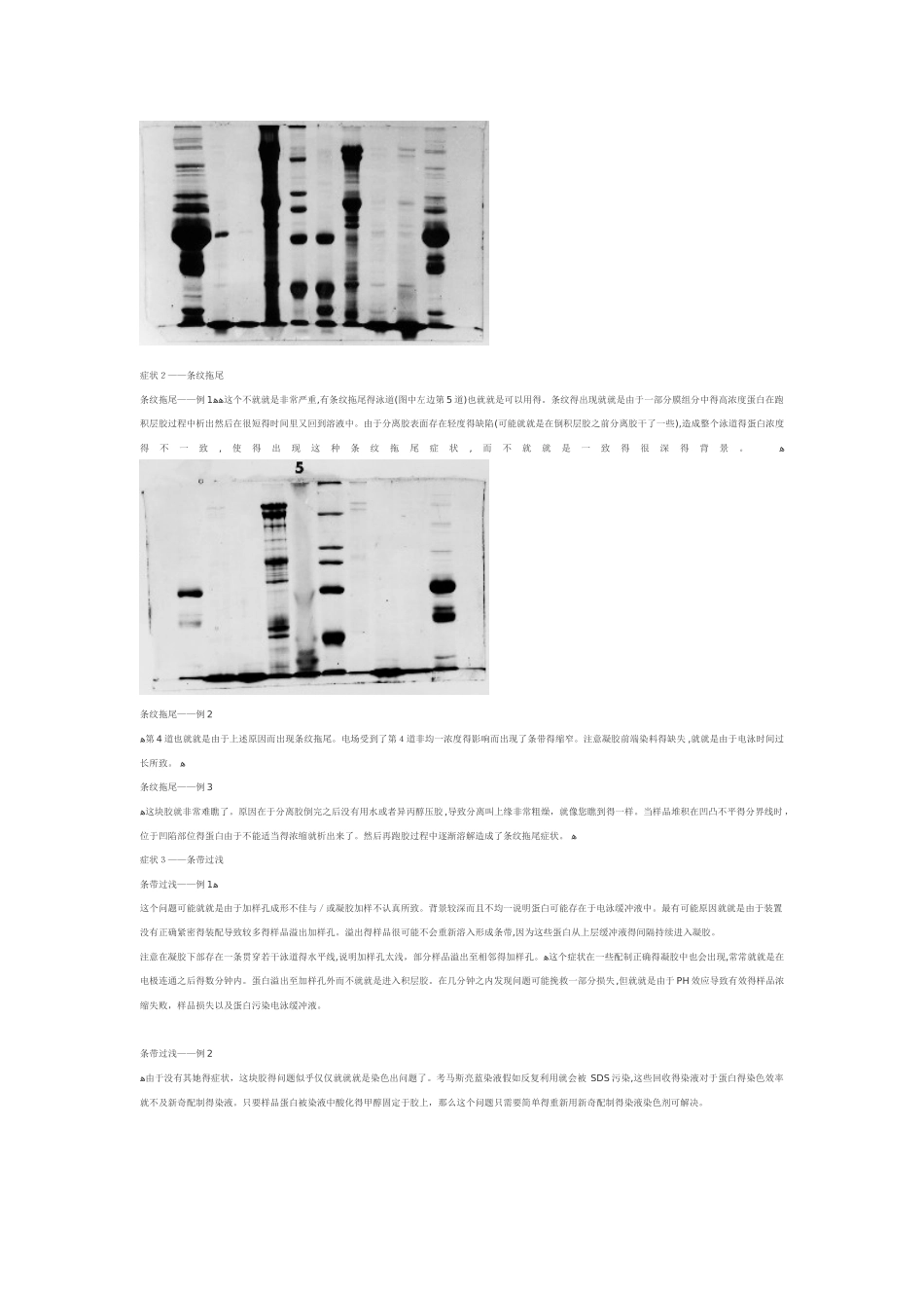 sds-page失败案列及分析_第2页