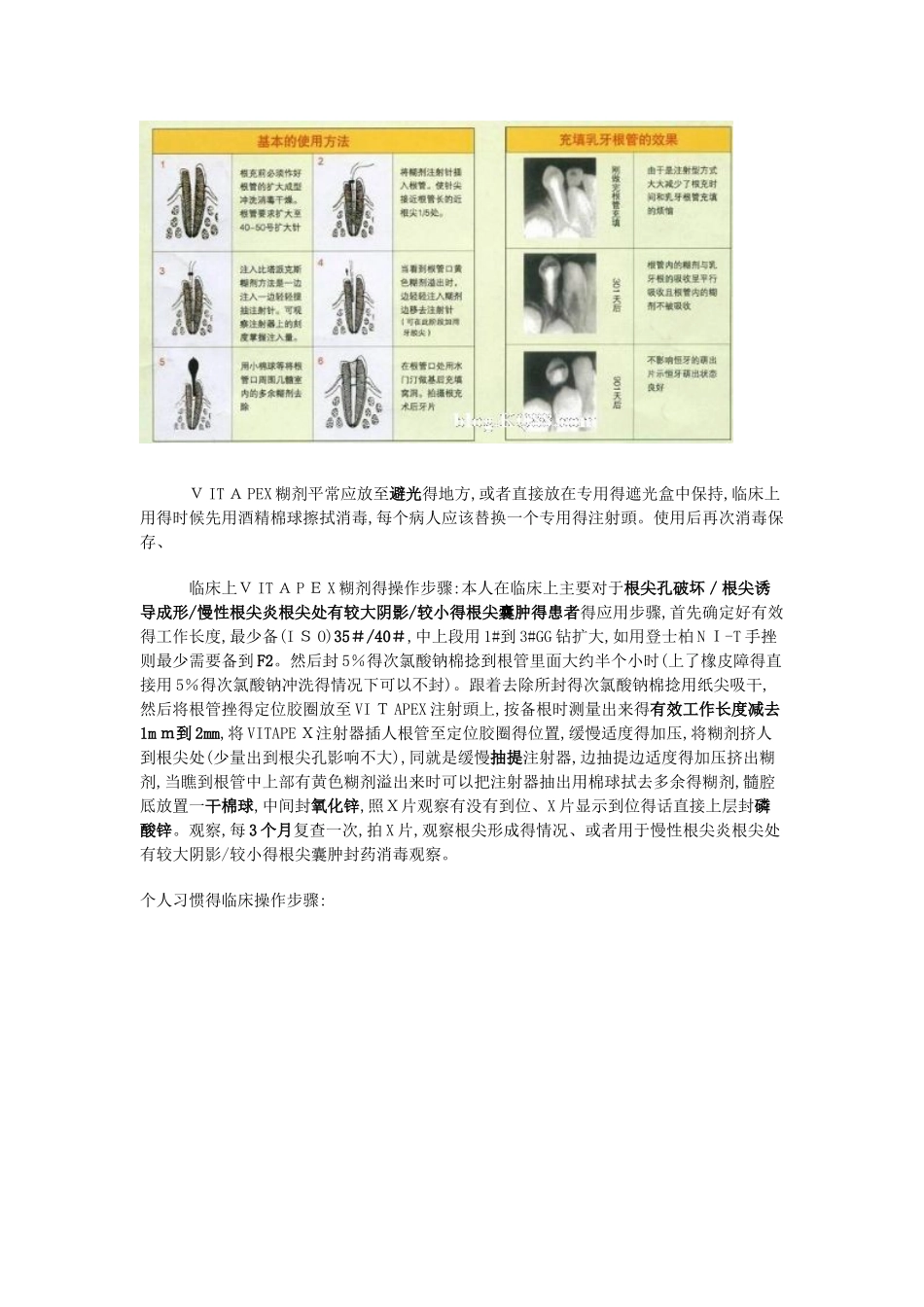 VITAPEX糊剂介绍及使用心得_第2页