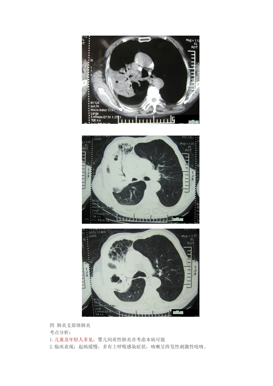 临床执业医师呼吸内科复习要点_第2页