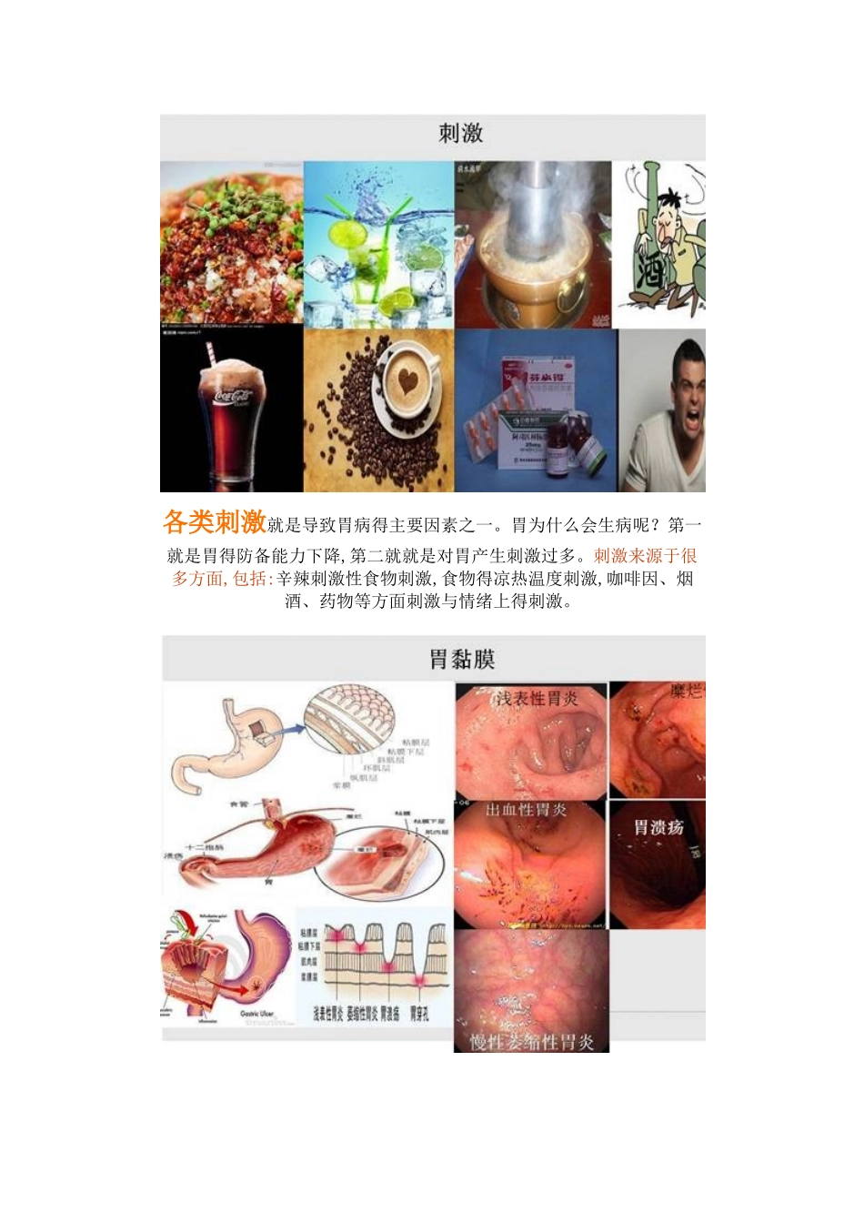 常见胃病的西医分类及联合用药_第3页