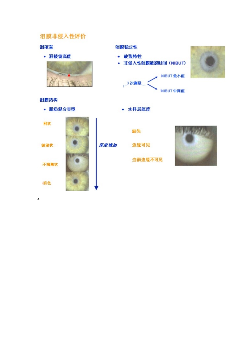 滴眼液成分特点对泪膜的效应_第3页