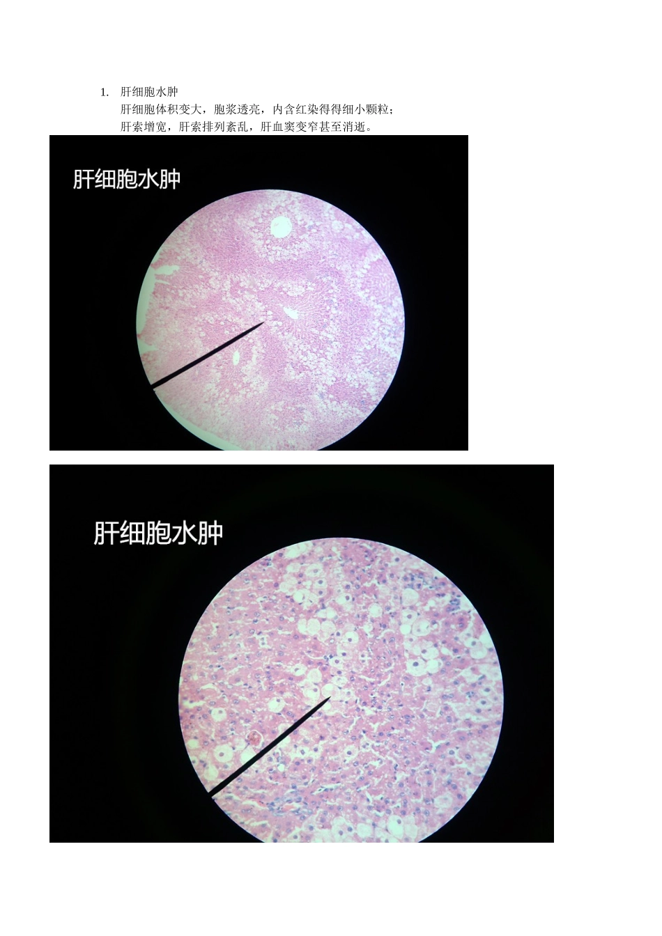 病理学 镜下切片_第1页