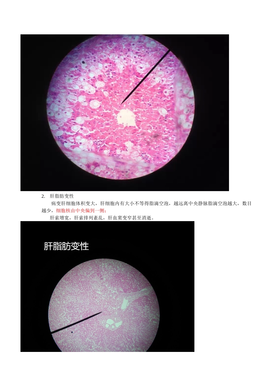 病理学 镜下切片_第2页
