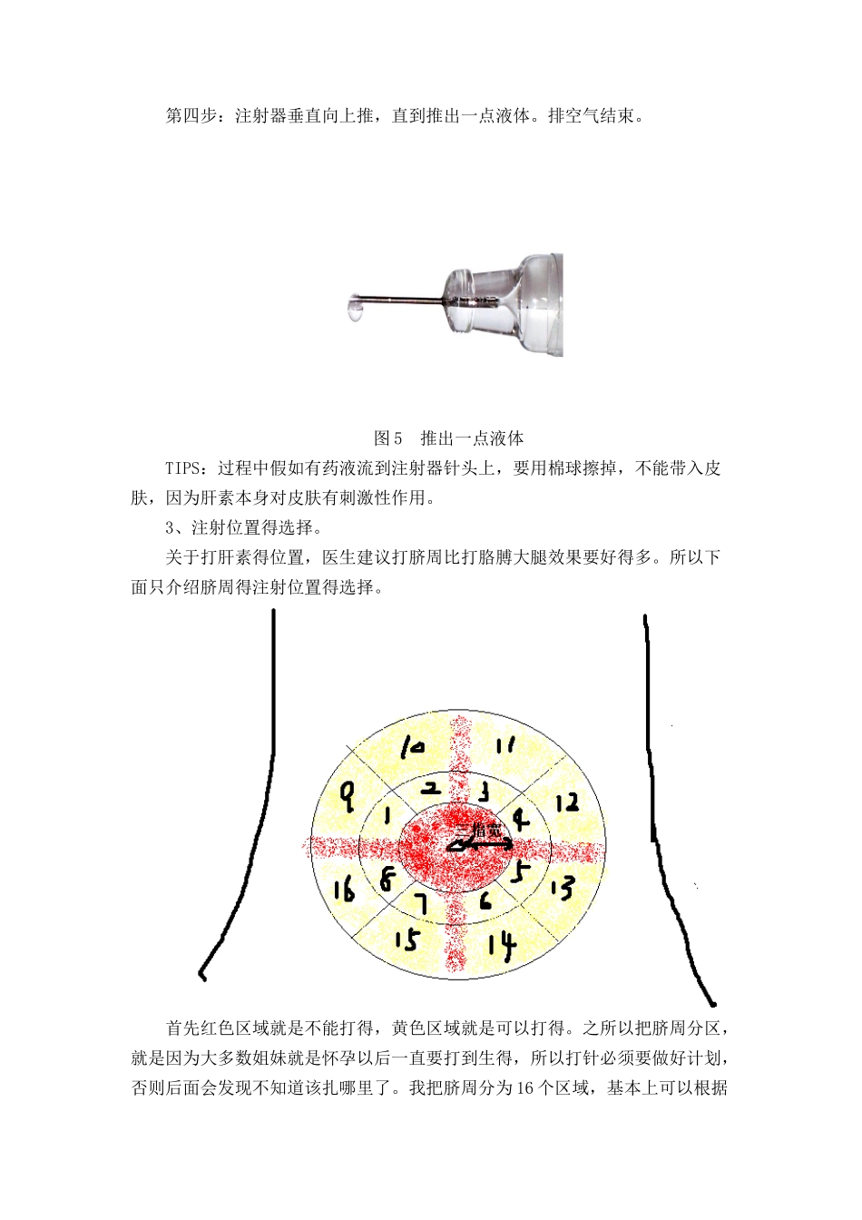 肝素的注射方法_第3页