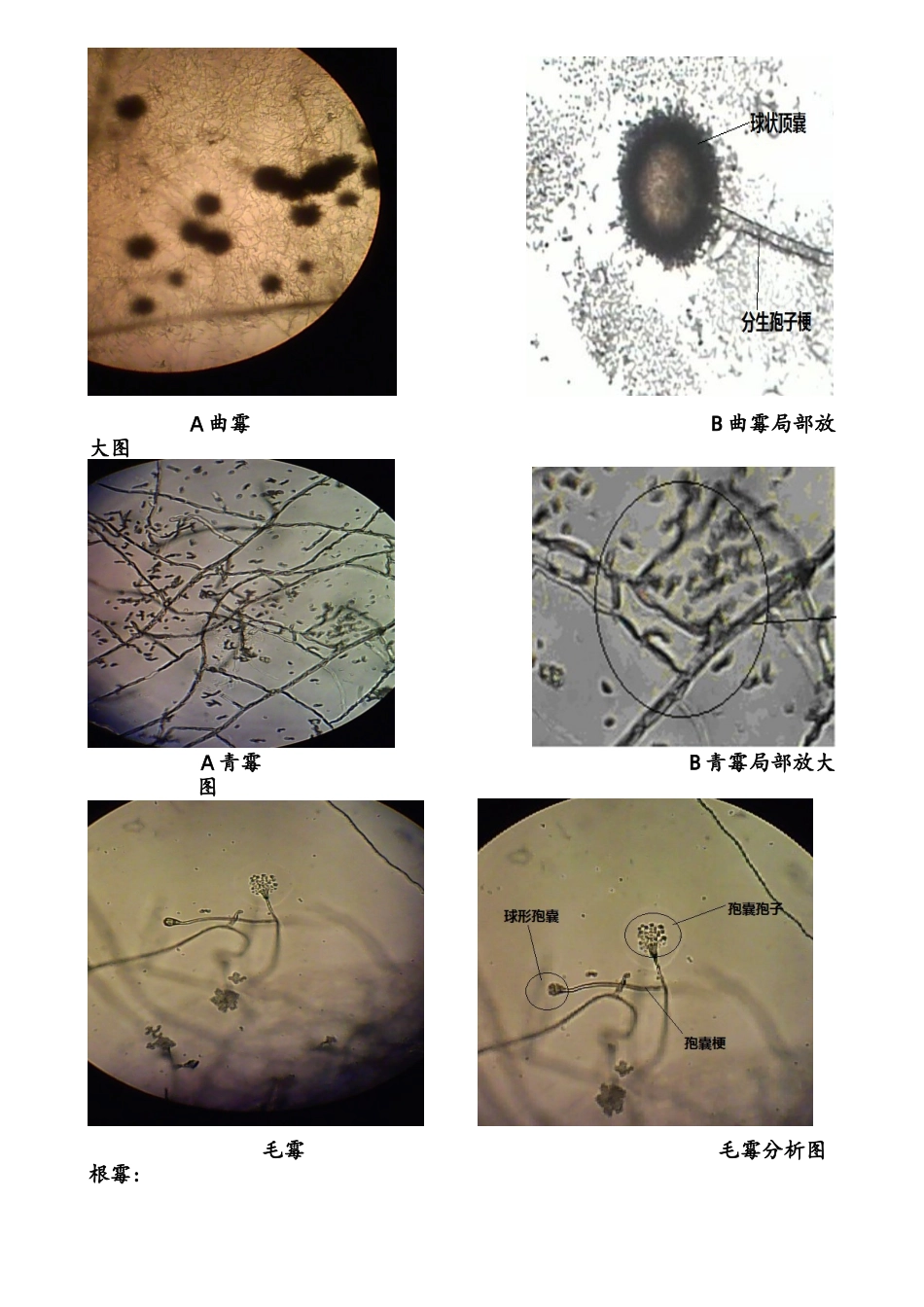 霉菌形态及菌落特征的观察_第2页
