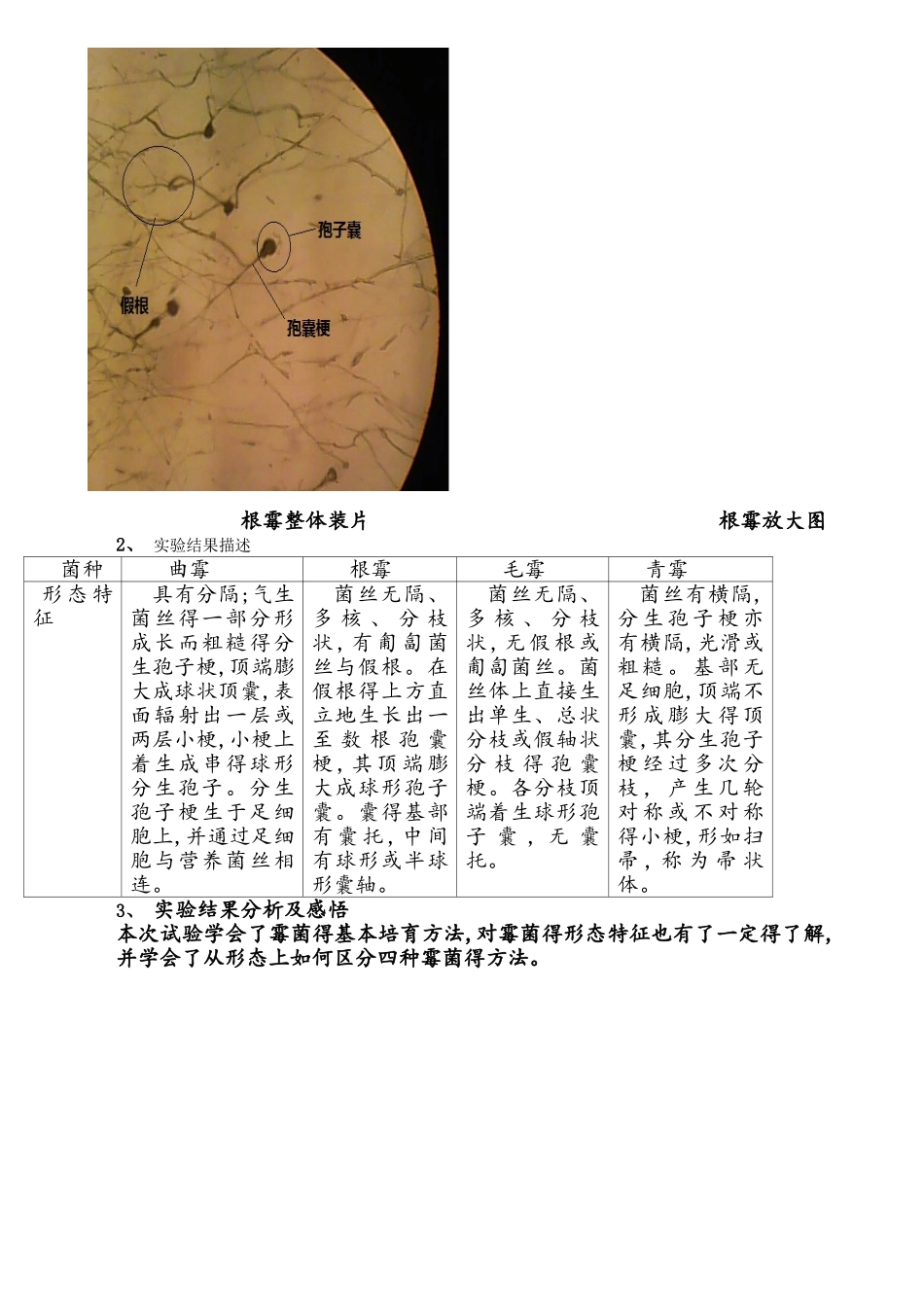 霉菌形态及菌落特征的观察_第3页