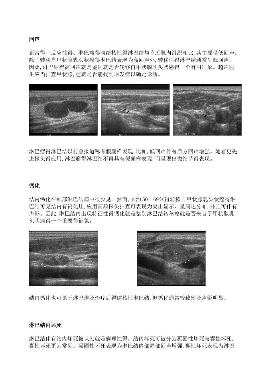 颈部淋巴结的超声诊断_第3页