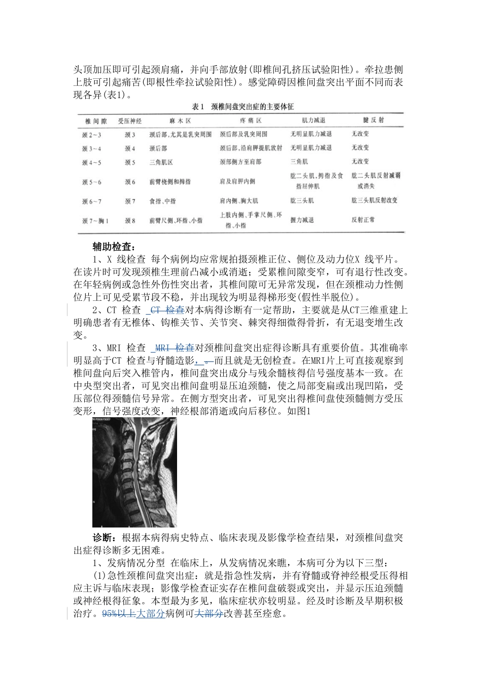 颈椎间盘突出症_第2页