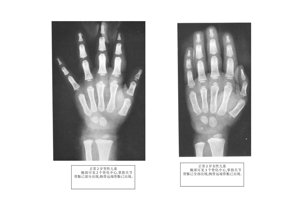 骨龄之对照标准_第2页