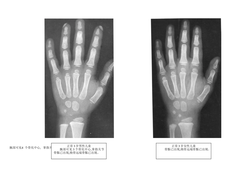 骨龄之对照标准_第3页