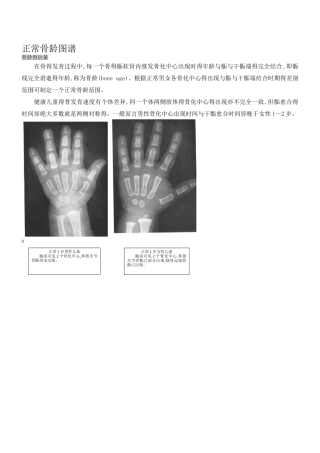 骨龄之对照标准