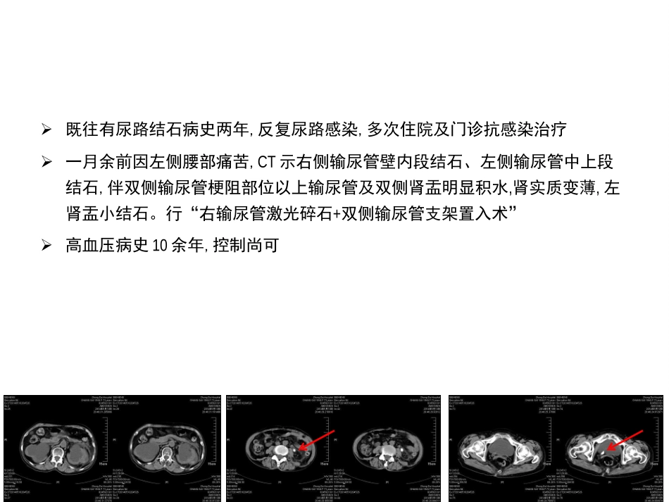 黄英姿从重症泌尿系感染引发得思考_第3页