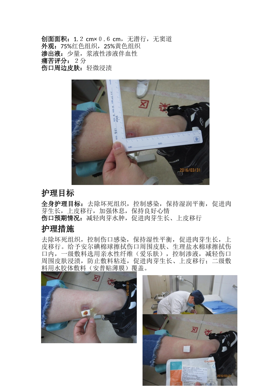 低温烫伤后伤口护理_第3页