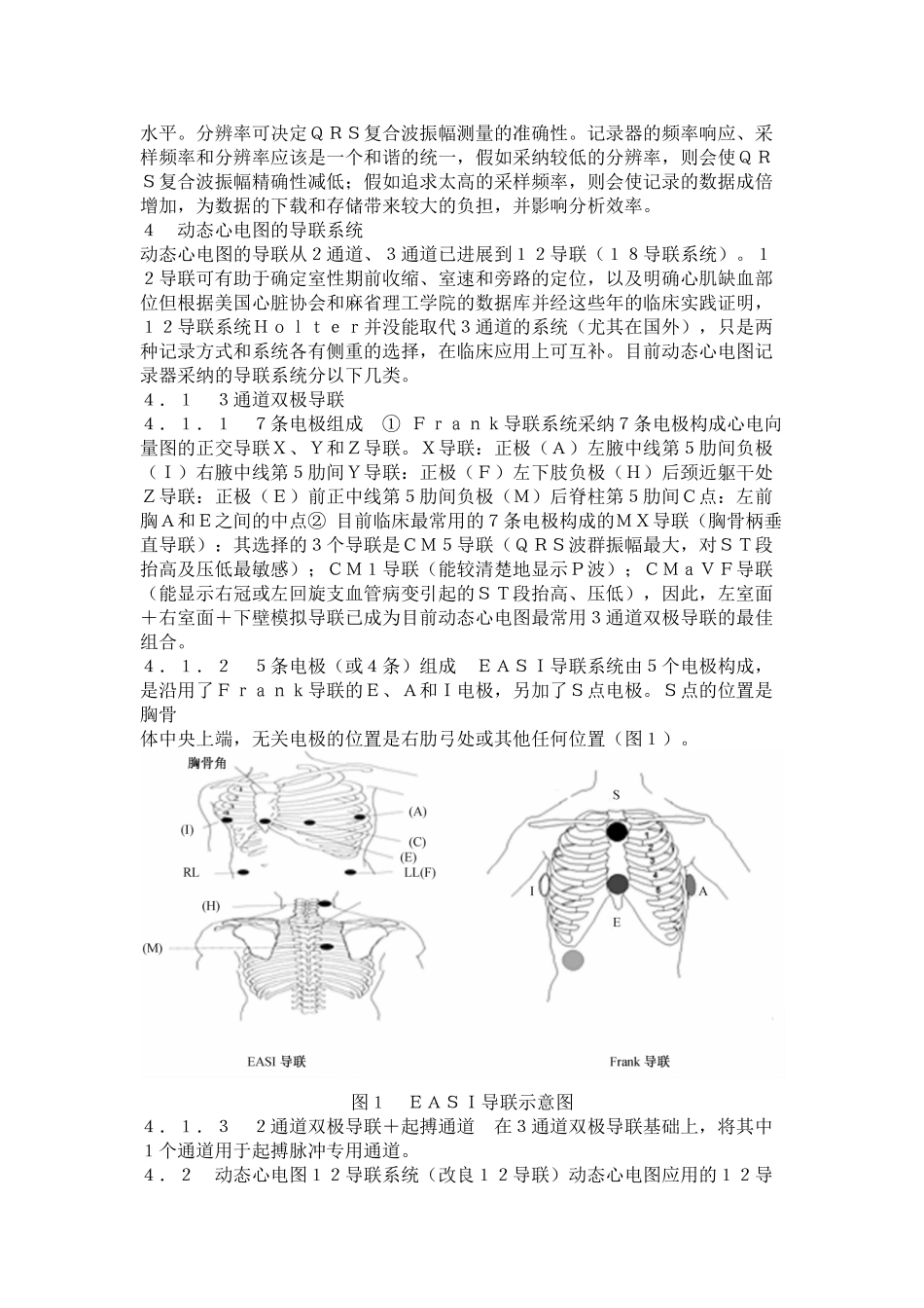 动态心电图临床应用规范_第2页