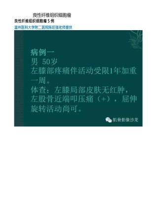 医学影像：良性纤维组织细胞瘤