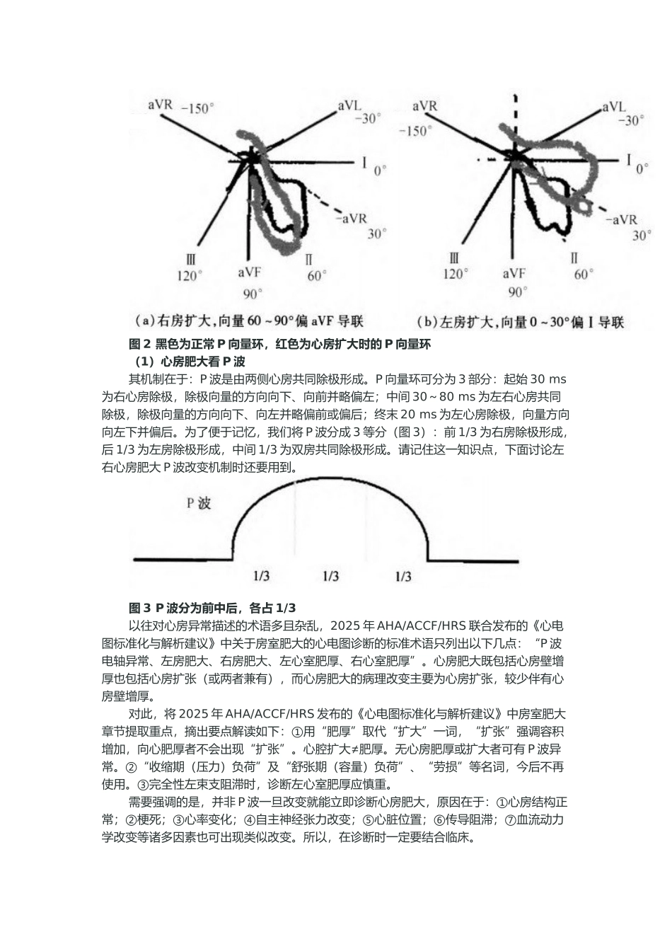图解心房心室肥大的心电图诊断_第3页