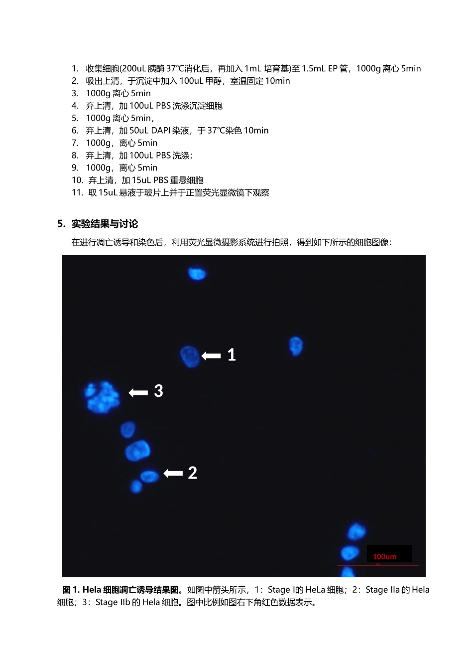 细胞凋亡诱导及检测伍国羽_第2页