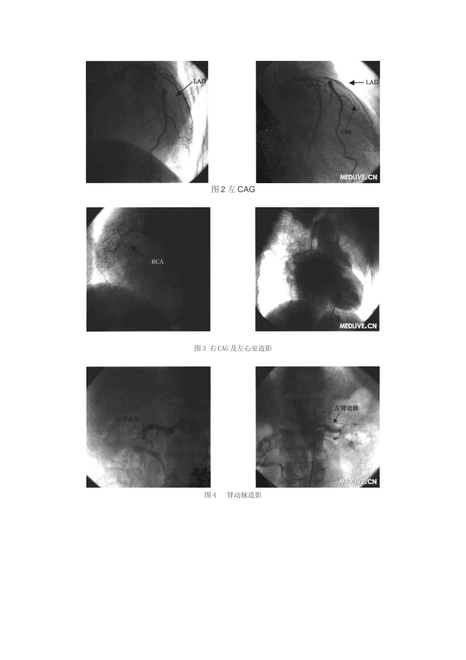 80岁高龄心脏病合并多器官病变诊疗经验_第3页