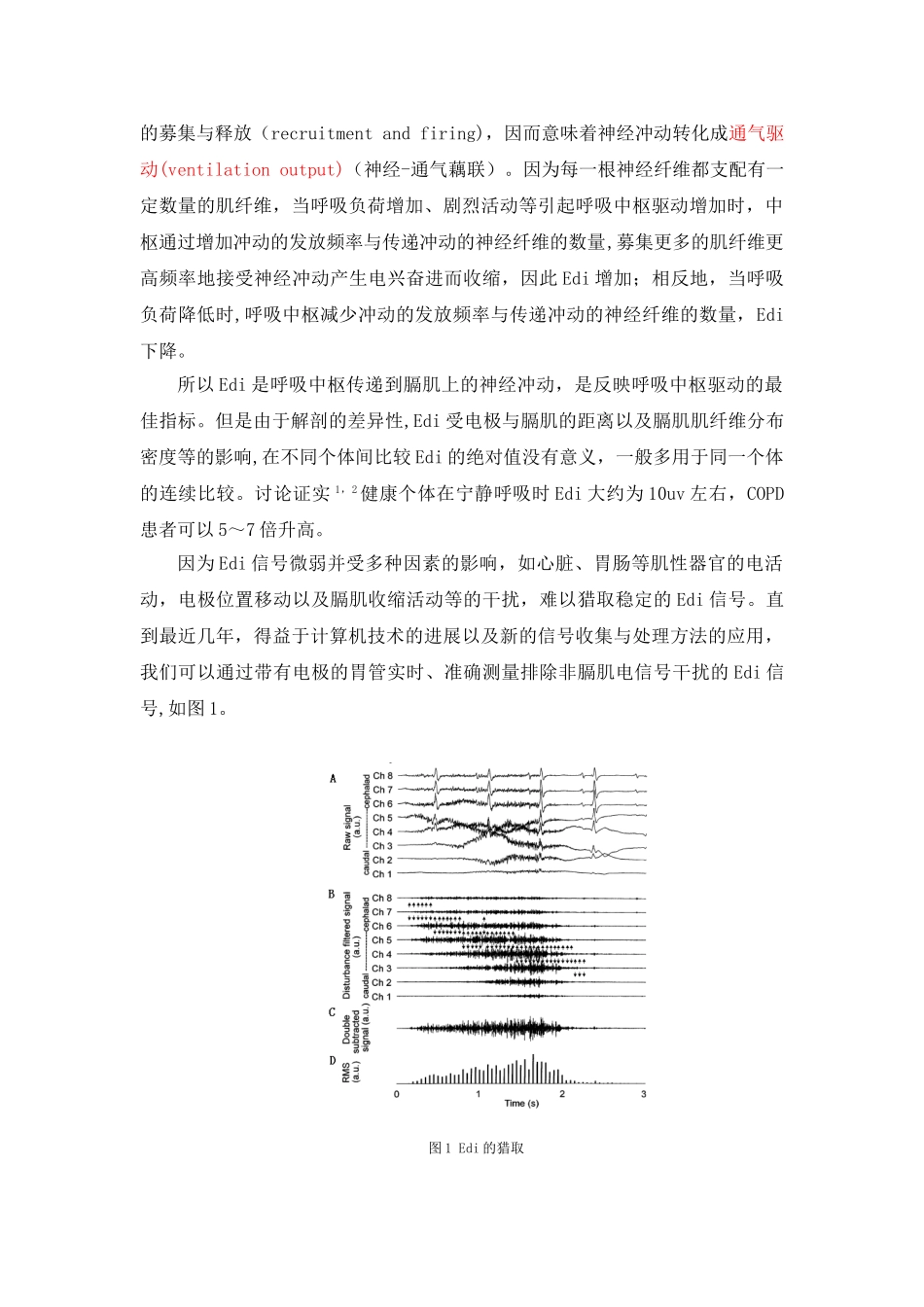 NAVA-一个全新的通气模式_第2页