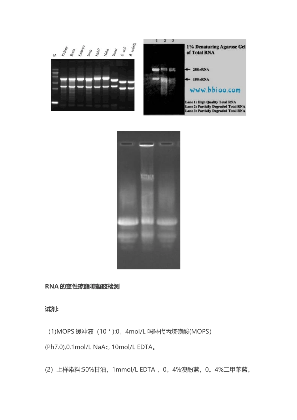 RNA的琼脂糖凝胶电泳实验原理和步骤_第3页