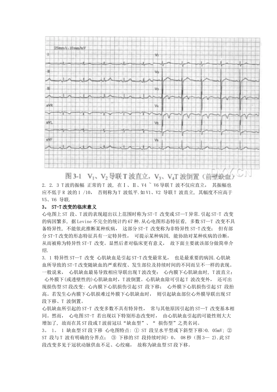 ST-T改变的临床意义_第3页