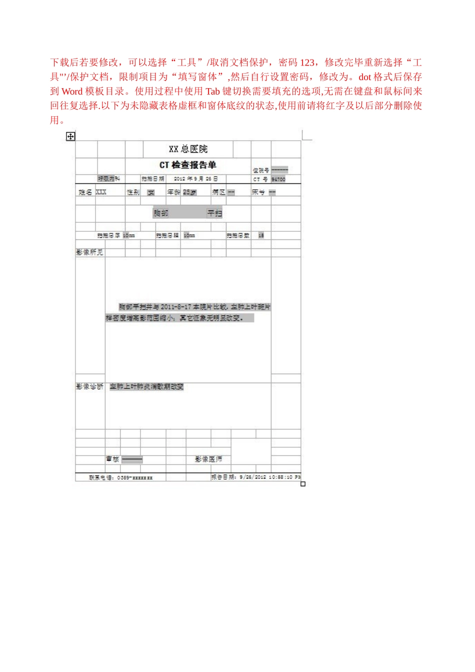 XXX医院CT检查报告单模板_第2页