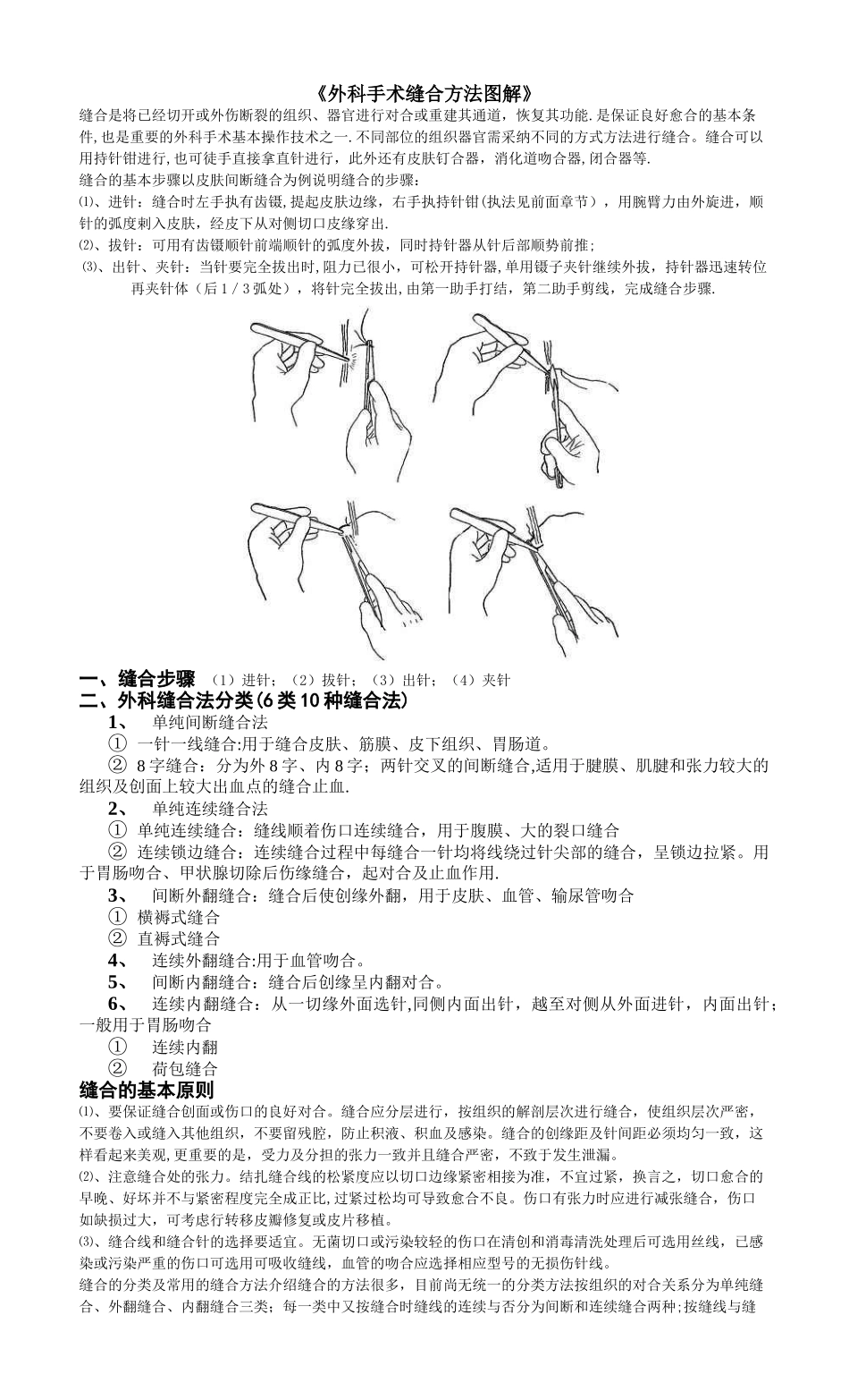 《手术缝合方法分类图解》_第1页