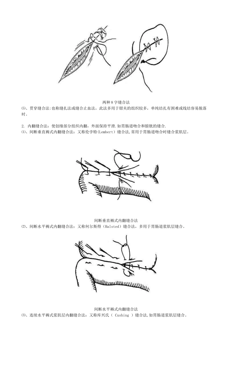 《手术缝合方法分类图解》_第3页