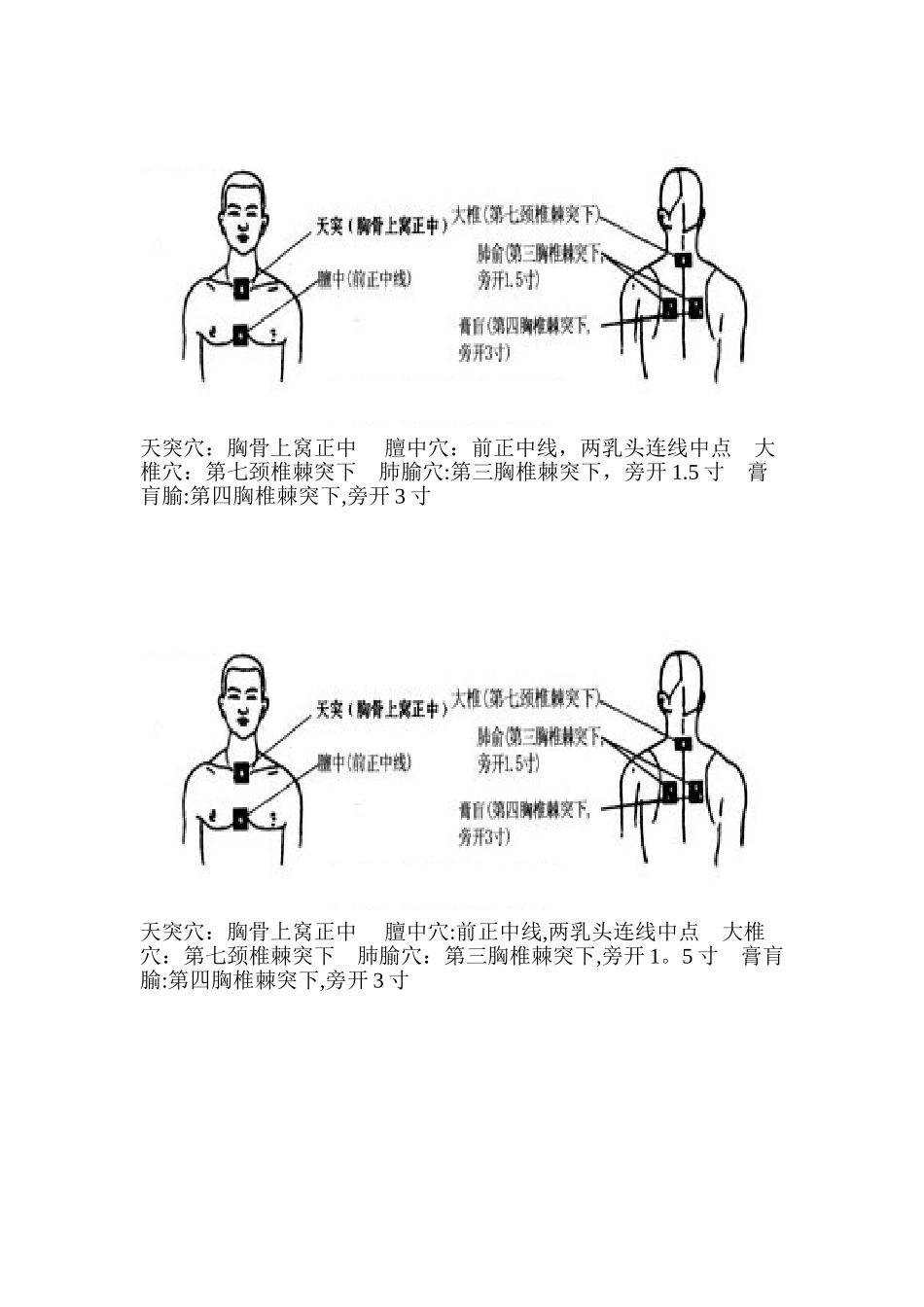 三伏贴穴位图-贴伏穴位图_第1页