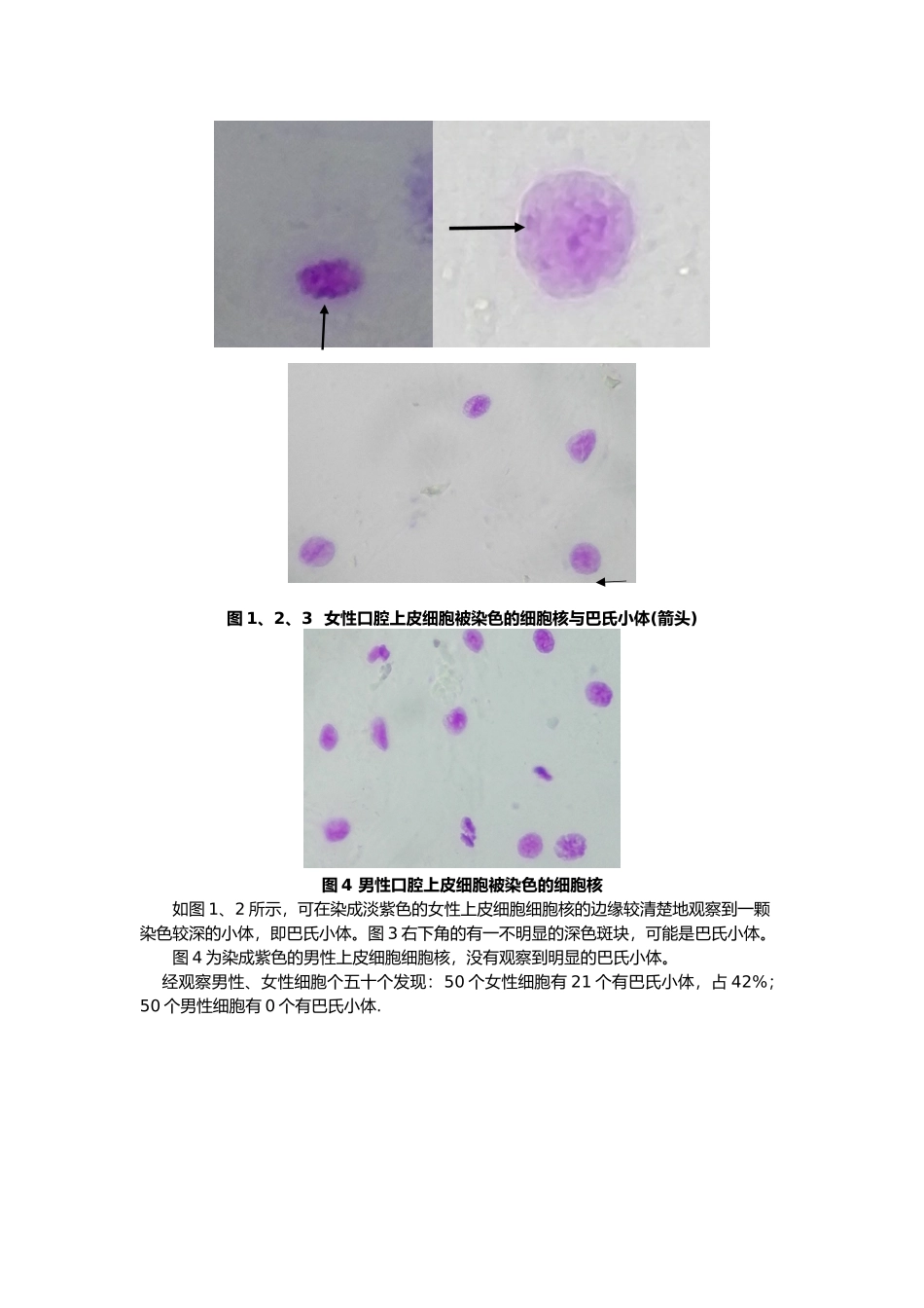 中山大学人类X染色质标本的制备与观察报告_第2页