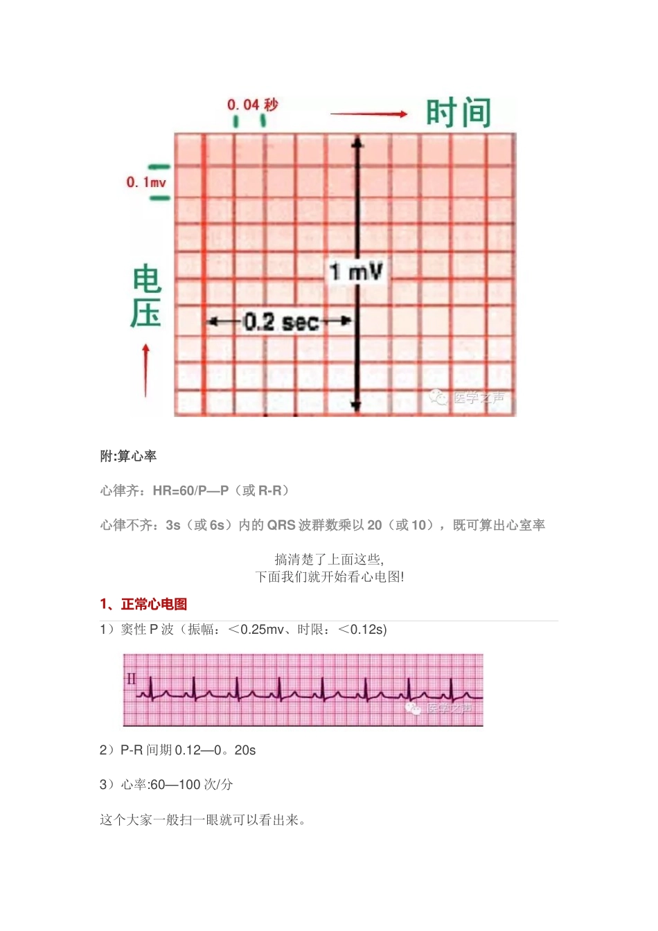 临床常见的11种心电图_第3页